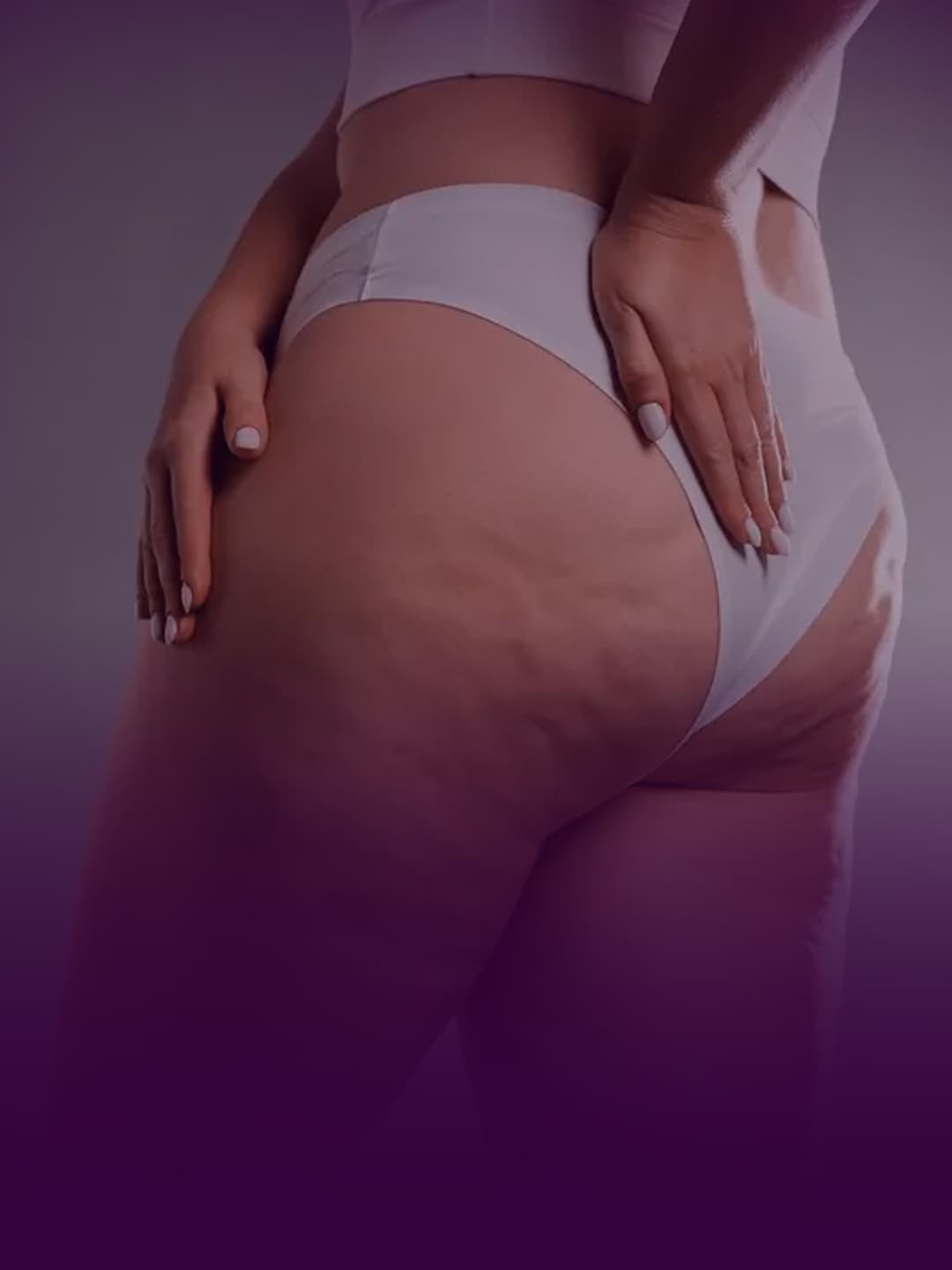 Compreensão conceitual do Lipedema